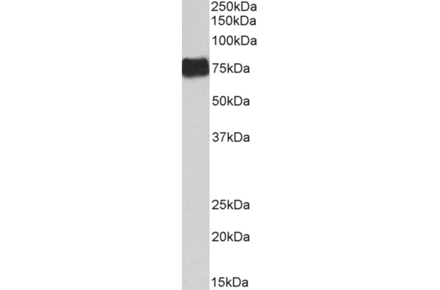 Western Blot - Anti-Fibrinogen alpha Chain Antibody (A82985) - Antibodies.com
