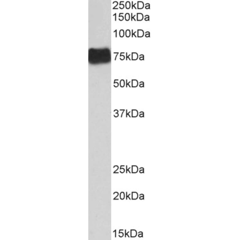 Western Blot - Anti-Fibrinogen alpha Chain Antibody (A82985) - Antibodies.com