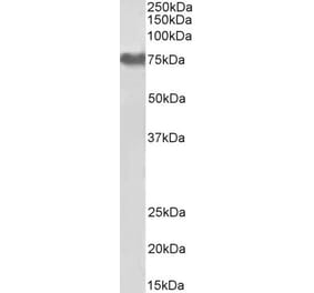 Western Blot - Anti-Fibrinogen alpha Chain Antibody (A82986) - Antibodies.com