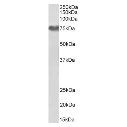 Western Blot - Anti-Fibrinogen alpha Chain Antibody (A82986) - Antibodies.com