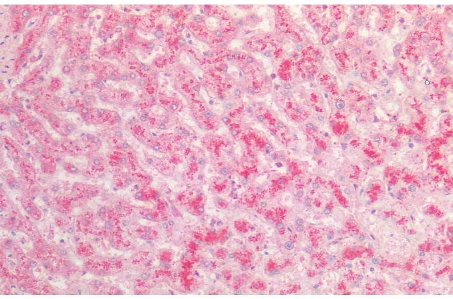 Immunohistochemistry - Anti-Fibrinogen alpha Chain Antibody (A82986) - Antibodies.com