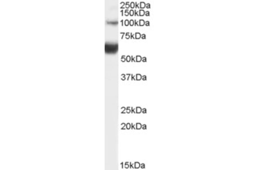Western Blot - Anti-HNF-1B Antibody (A82987) - Antibodies.com