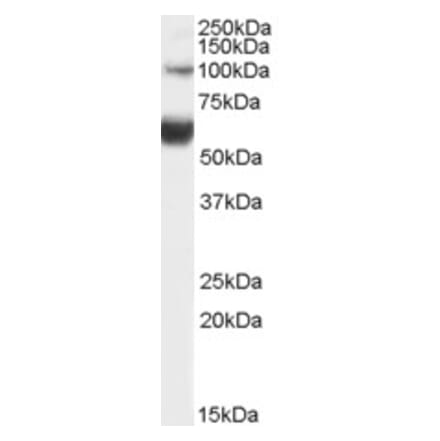 Western Blot - Anti-HNF-1B Antibody (A82987) - Antibodies.com