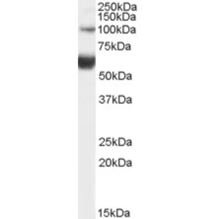 Western Blot - Anti-HNF-1B Antibody (A82987) - Antibodies.com