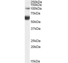 Western Blot - Anti-HNF1B Antibody (A82987) - Antibodies.com