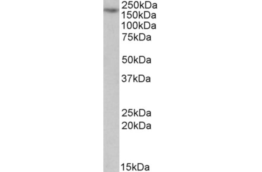 Western Blot - Anti-MYO5A Antibody (A82988) - Antibodies.com