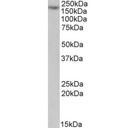 Western Blot - Anti-MYO5A Antibody (A82988) - Antibodies.com