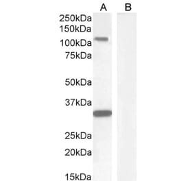 Western Blot - Anti-c-Kit Antibody (A82989) - Antibodies.com