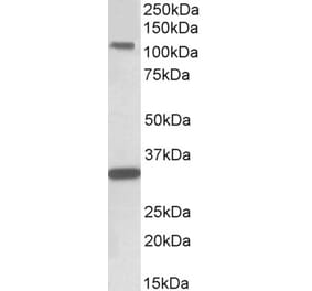 Western Blot - Anti-KIT Antibody (A82989) - Antibodies.com