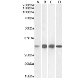 Western Blot - Anti-Ketohexokinase Antibody (A82990) - Antibodies.com