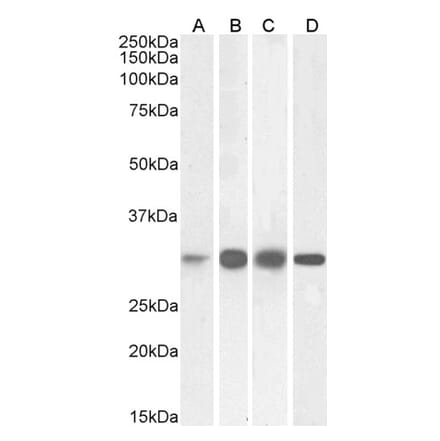 Western Blot - Anti-Ketohexokinase Antibody (A82990) - Antibodies.com