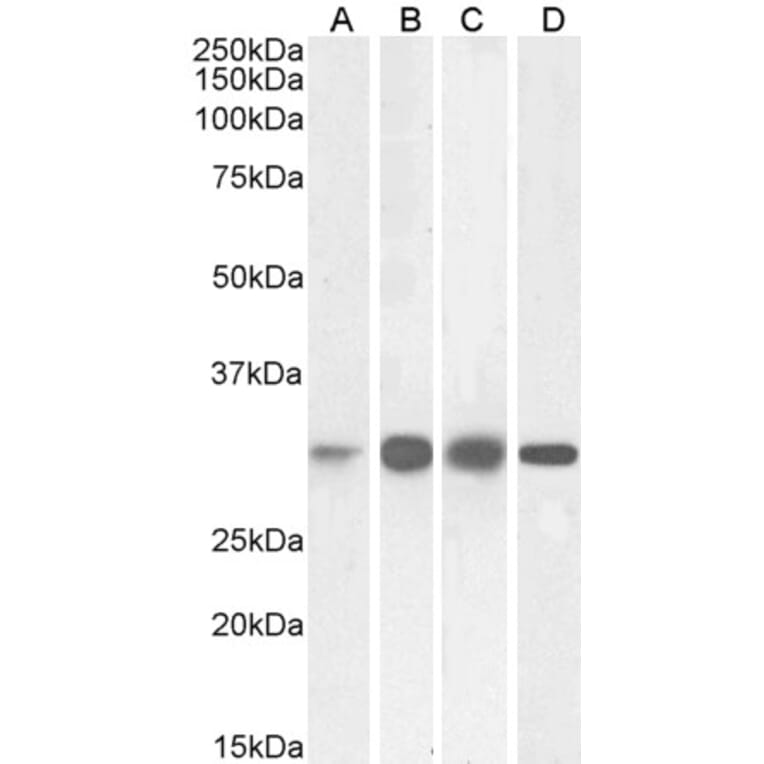 Western Blot - Anti-Ketohexokinase Antibody (A82990) - Antibodies.com