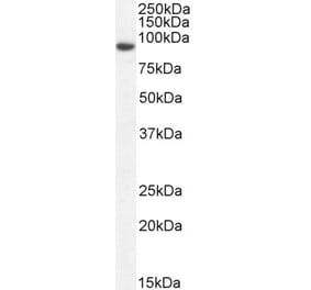 Western Blot - Anti-Gelsolin Antibody (A82992) - Antibodies.com