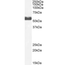 Western Blot - Anti-CYP2D6 Antibody (A82994) - Antibodies.com