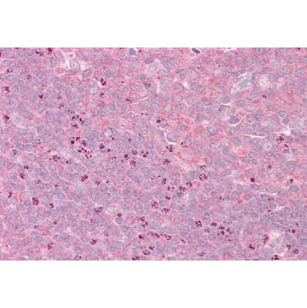 Immunohistochemistry - Anti-GRASP1 Antibody (A82997) - Antibodies.com