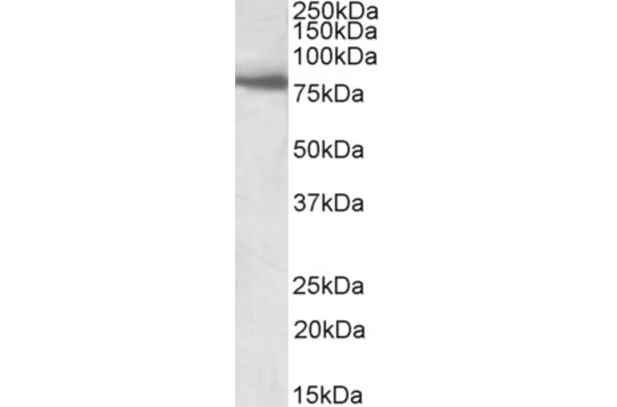 Western Blot - Anti-BBS7 Antibody (A83000) - Antibodies.com