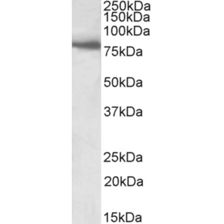 Western Blot - Anti-BBS7 Antibody (A83000) - Antibodies.com