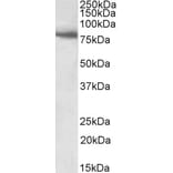 Western Blot - Anti-BBS7 Antibody (A83000) - Antibodies.com