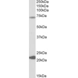 Western Blot - Anti-KCNN2/SK2 Antibody (A83002) - Antibodies.com