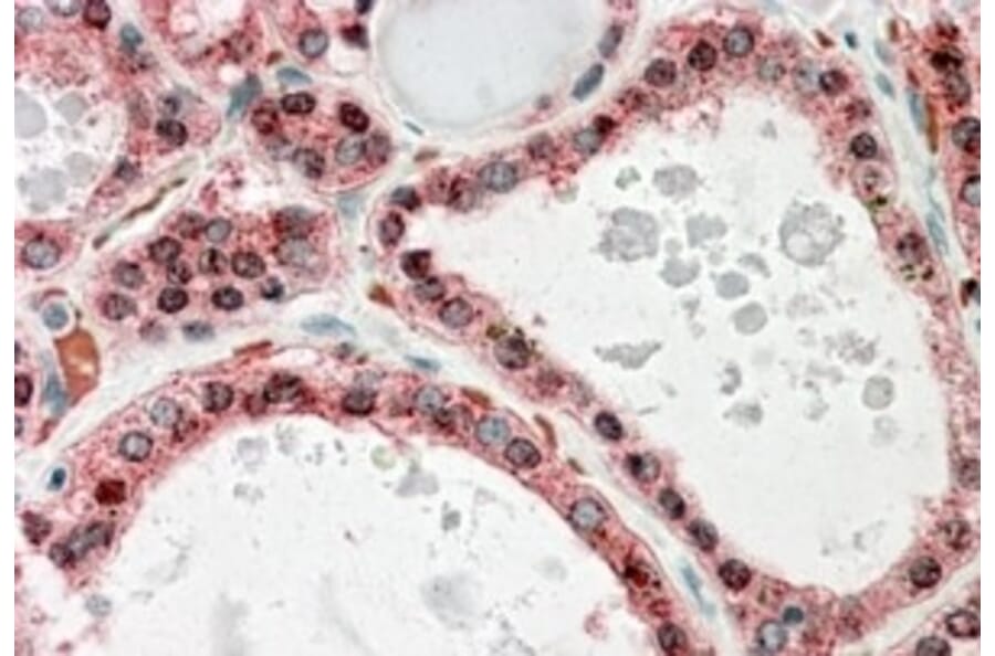 Immunohistochemistry - Anti-KCNN2/SK2 Antibody (A83002) - Antibodies.com