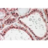 Immunohistochemistry - Anti-KCNN2/SK2 Antibody (A83002) - Antibodies.com