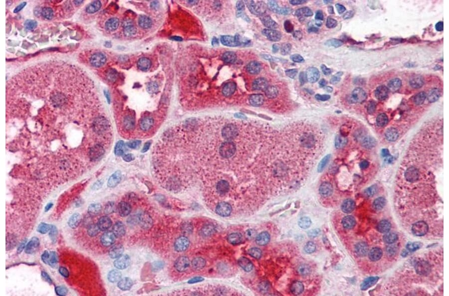 Immunohistochemistry - Anti-KCNN2/SK2 Antibody (A83002) - Antibodies.com