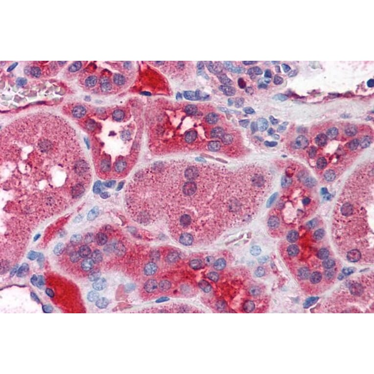 Immunohistochemistry - Anti-KCNN2/SK2 Antibody (A83002) - Antibodies.com