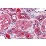 Immunohistochemistry - Anti-KCNN2/SK2 Antibody (A83002) - Antibodies.com