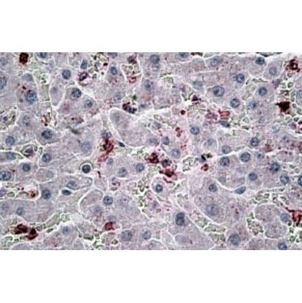 Immunohistochemistry - Anti-CCL20 Antibody (A83004) - Antibodies.com