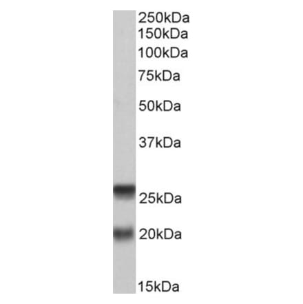 Western Blot - Anti-SNAP23 Antibody (A83005) - Antibodies.com