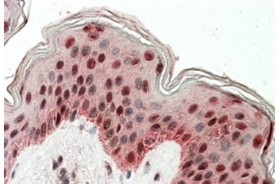 Immunohistochemistry - Anti-TIAL1 + TIA Antibody (A83006) - Antibodies.com