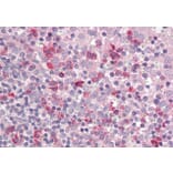 Immunohistochemistry - Anti-LAIR1 Antibody (A83007) - Antibodies.com