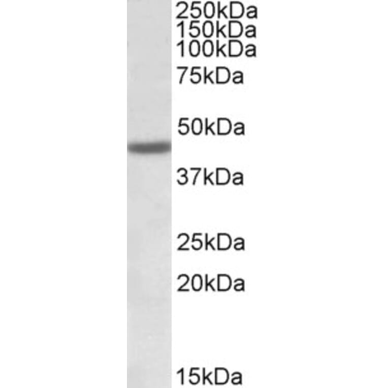 Western Blot - Anti-FANCL Antibody (A83008) - Antibodies.com