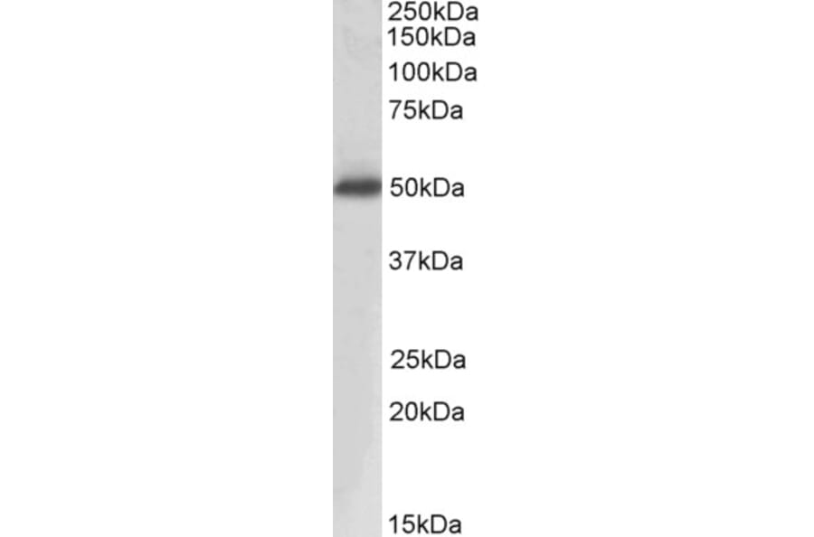 Western Blot - Anti-PAP Antibody (A83009) - Antibodies.com