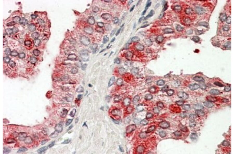 Immunohistochemistry - Anti-PAP Antibody (A83009) - Antibodies.com