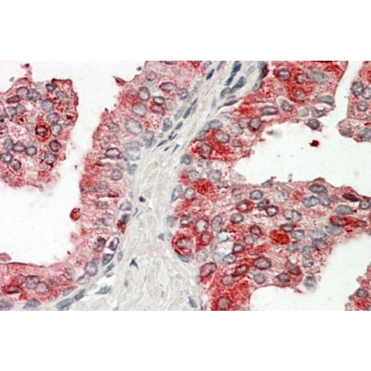 Immunohistochemistry - Anti-PAP Antibody (A83009) - Antibodies.com