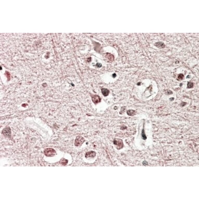 Immunohistochemistry - Anti-GRM2 Antibody (A83011) - Antibodies.com
