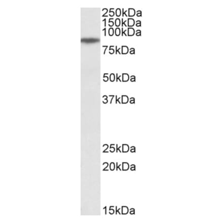 Western Blot - Anti-GGCX Antibody (A83012) - Antibodies.com