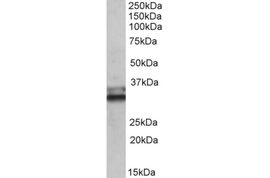 Western Blot - Anti-ETFA Antibody (A83013) - Antibodies.com
