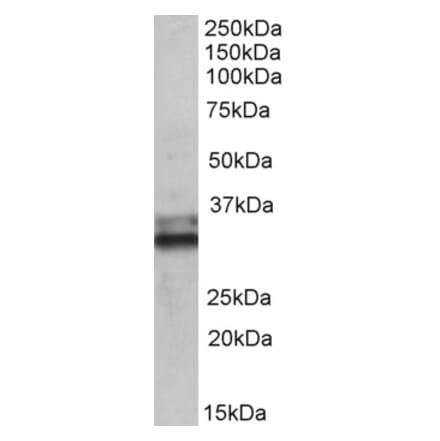 Western Blot - Anti-ETFA Antibody (A83013) - Antibodies.com