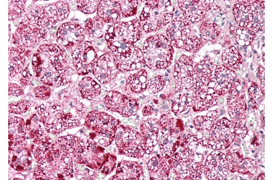 Immunohistochemistry - Anti-ETFA Antibody (A83013) - Antibodies.com