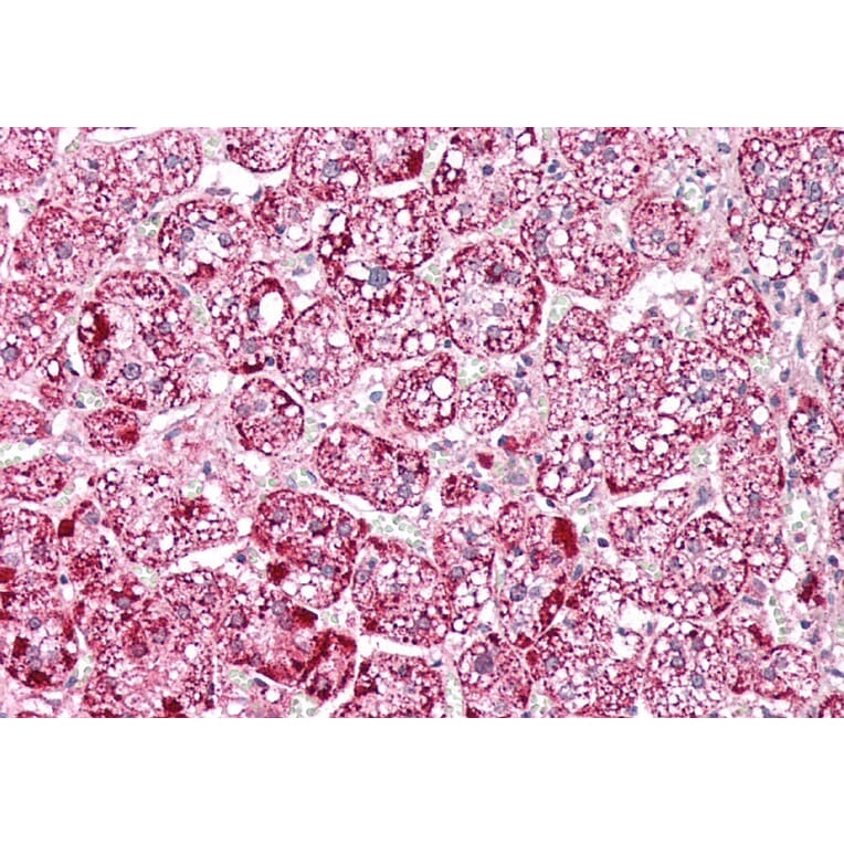 Immunohistochemistry - Anti-ETFA Antibody (A83013) - Antibodies.com