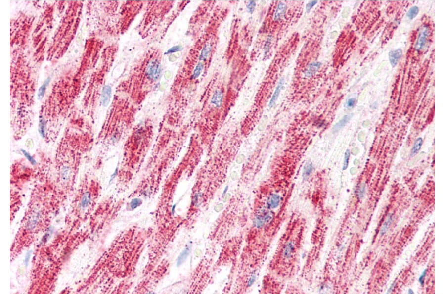 Immunohistochemistry - Anti-ETFA Antibody (A83013) - Antibodies.com