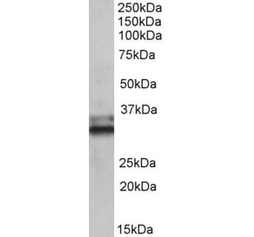 Western Blot - Anti-ETFA Antibody (A83013) - Antibodies.com