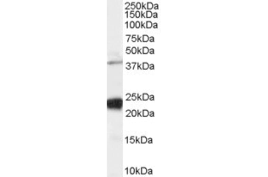 Western Blot - Anti-GIPC1 Antibody (A83014) - Antibodies.com