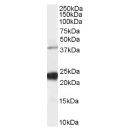 Western Blot - Anti-GIPC1 Antibody (A83014) - Antibodies.com