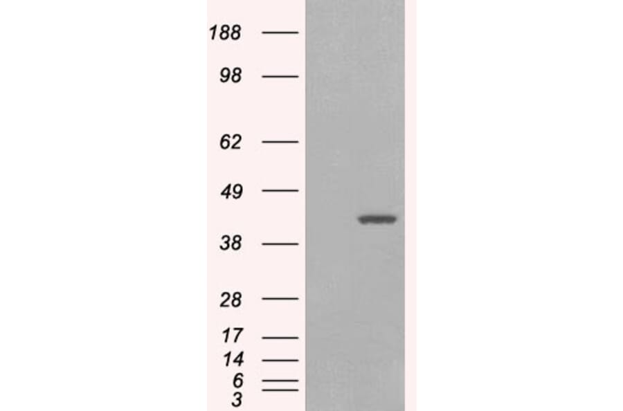 Western Blot - Anti-GIPC1 Antibody (A83014) - Antibodies.com