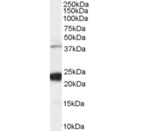 Western Blot - Anti-GIPC1 Antibody (A83014) - Antibodies.com
