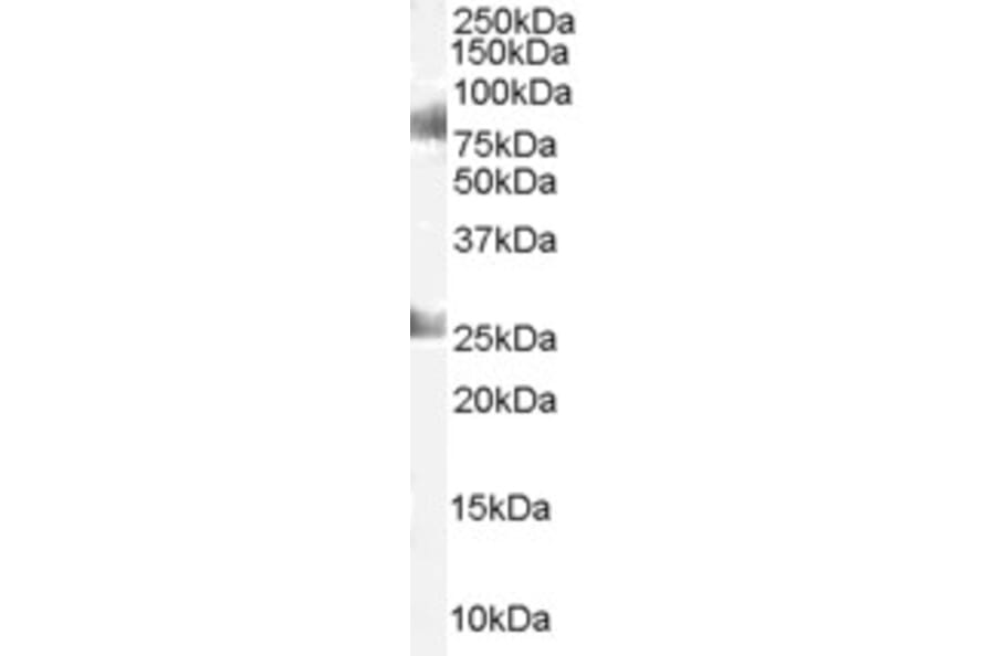 Western Blot - Anti-CDYL Antibody (A83015) - Antibodies.com
