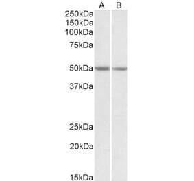 Western Blot - Anti-GNAS Antibody (A83016) - Antibodies.com